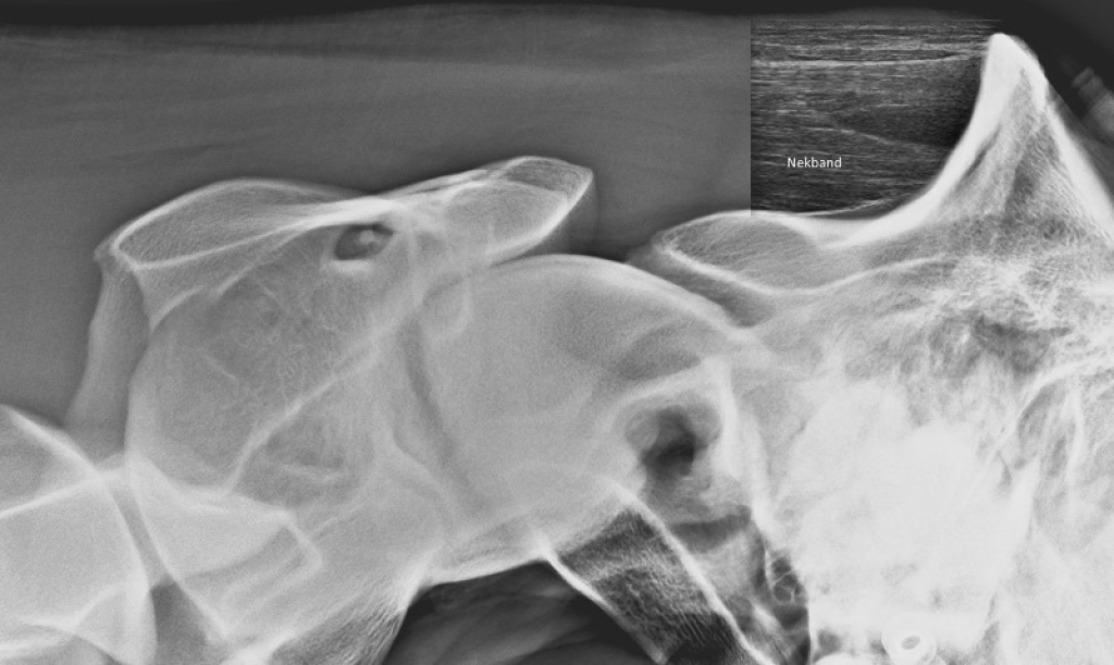 Echobeeld en röntgenfoto van het achterhoofd