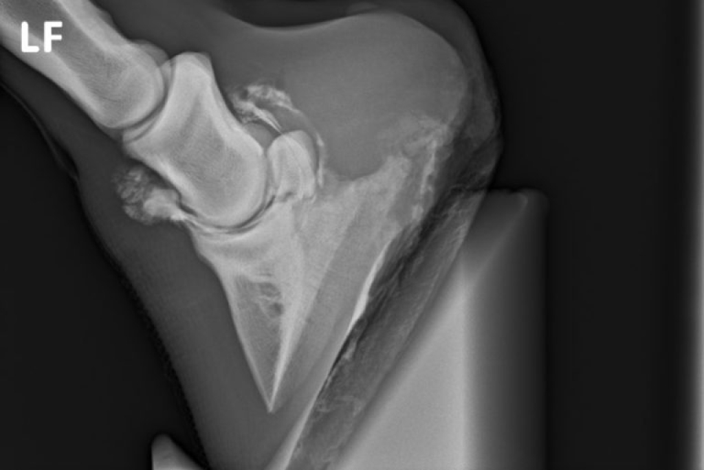 Röntgenopname van een slijmbeurs na injectie met contrast medium.