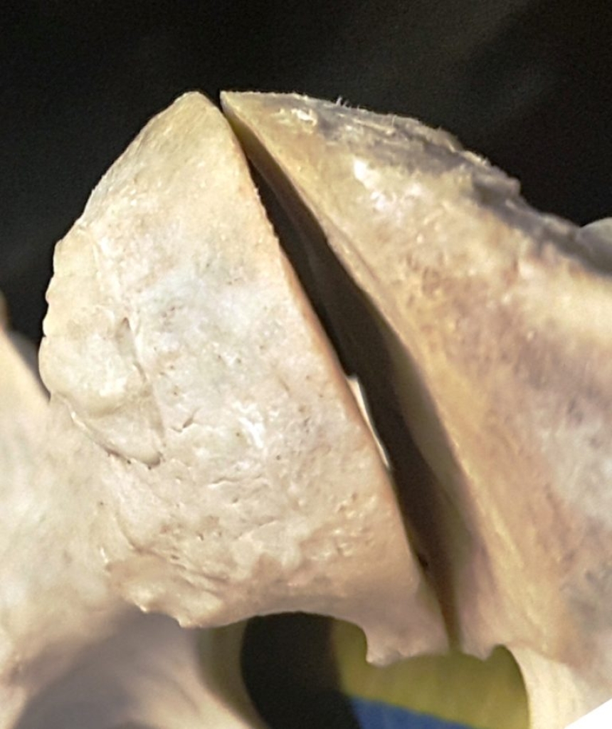 Facetgewricht zoals op echobeelden